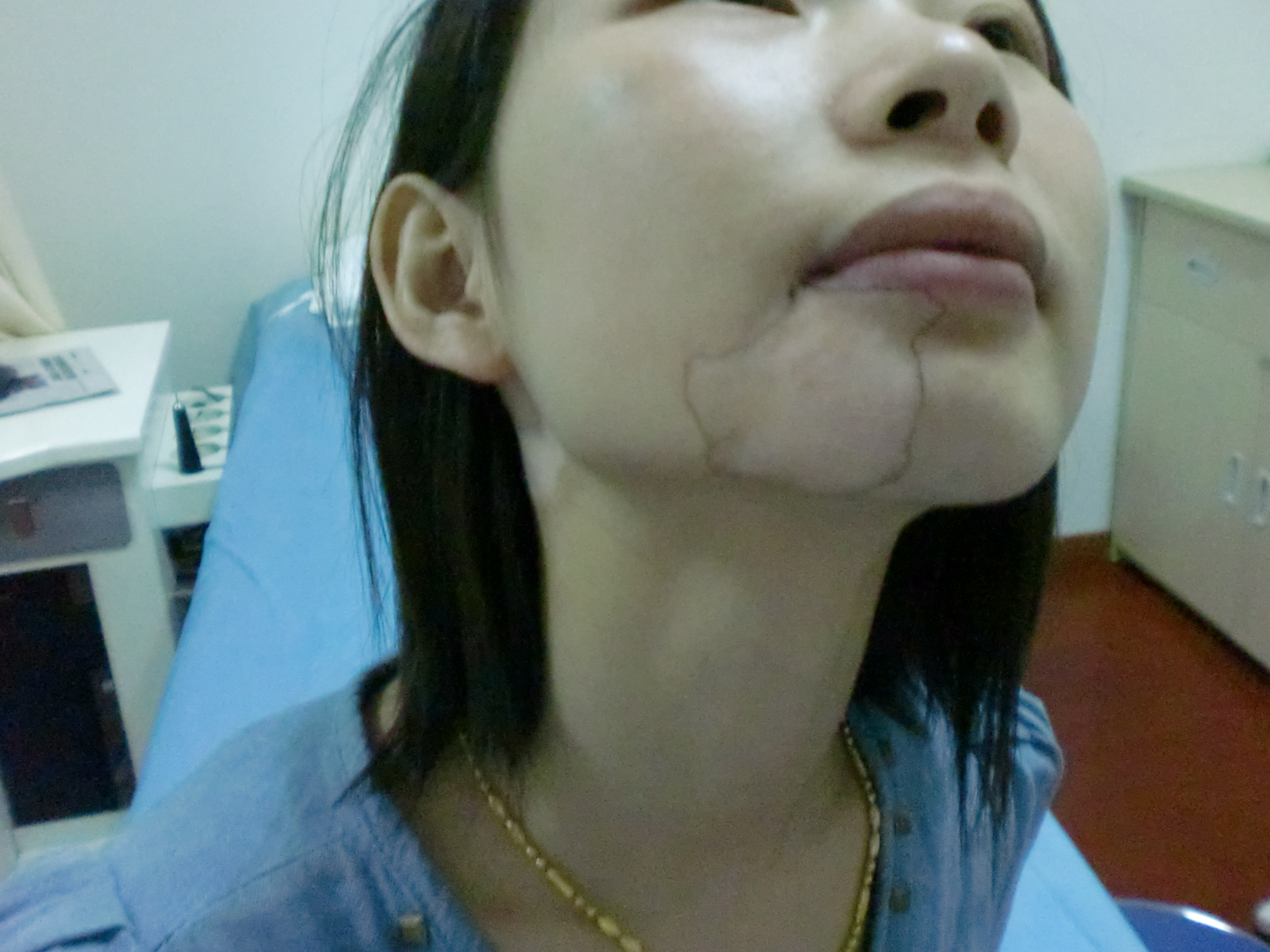 女性白癜风患者常识.JPG